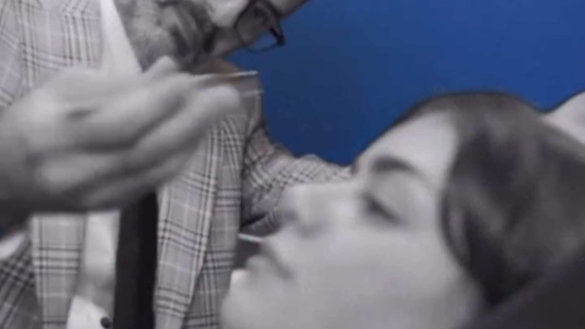 جراحی بینی متناسب با اجزای صورت | دکتر جواد یزدانی