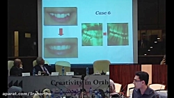 ارتونیوز : مینی اسکرو و هدایت...