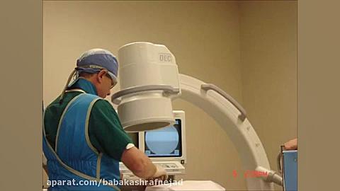 جراحی دیسك با لیزر دکتر بابک اشرف نژاد