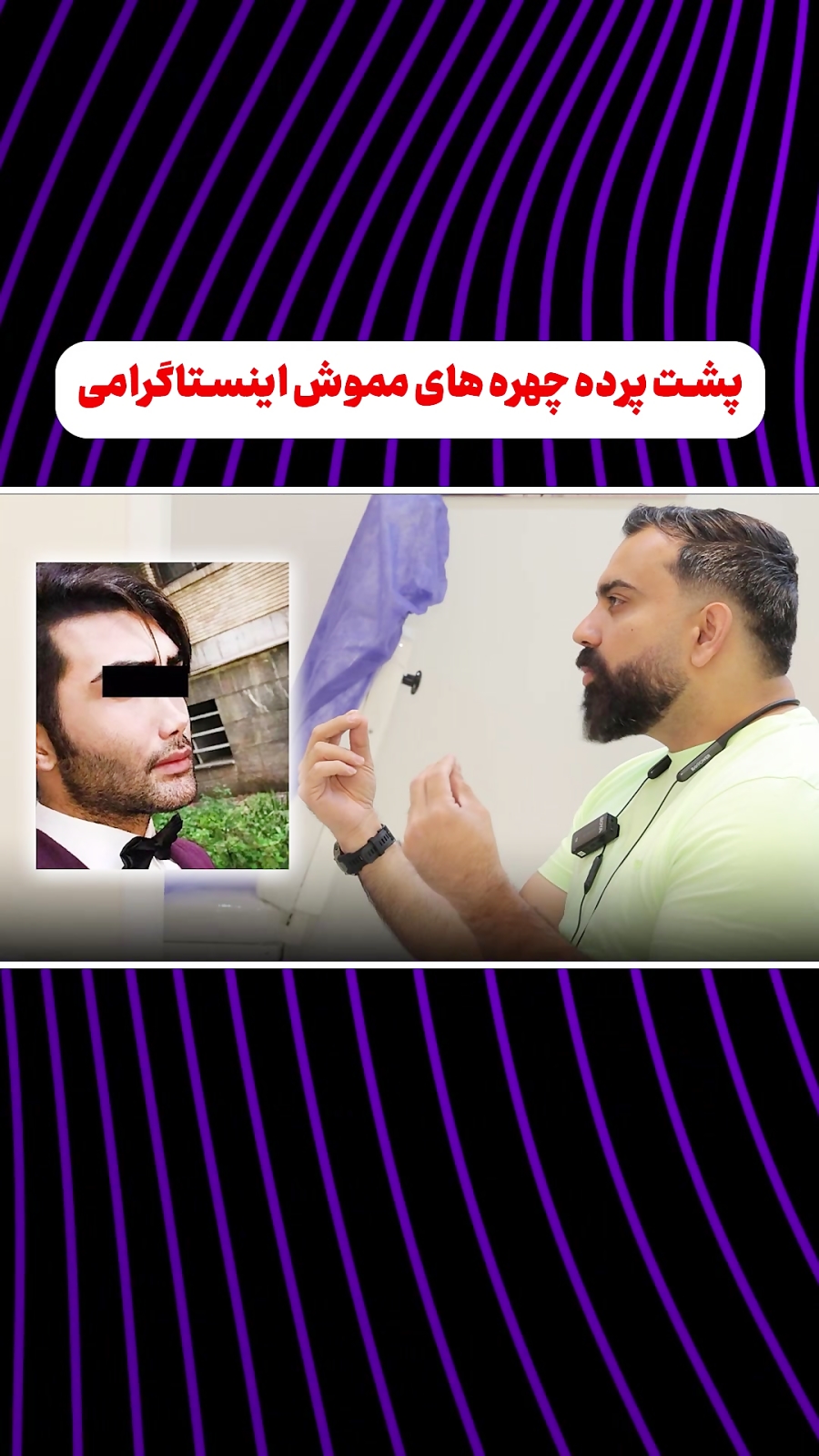 توضیحات دکتر منصوره جمشیدیان طهرانی در مورد واقعیت جراحی پلاستیک صورت