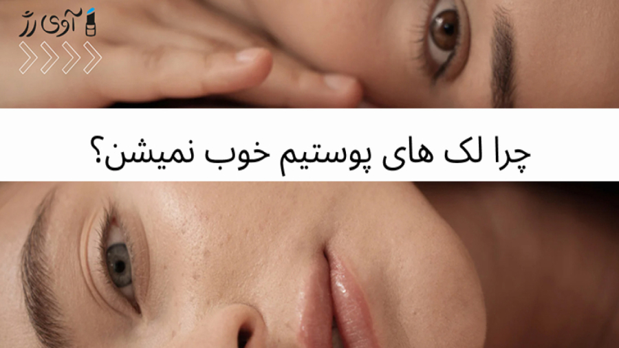 چرا لک های پوستیم خوب نمیشن؟