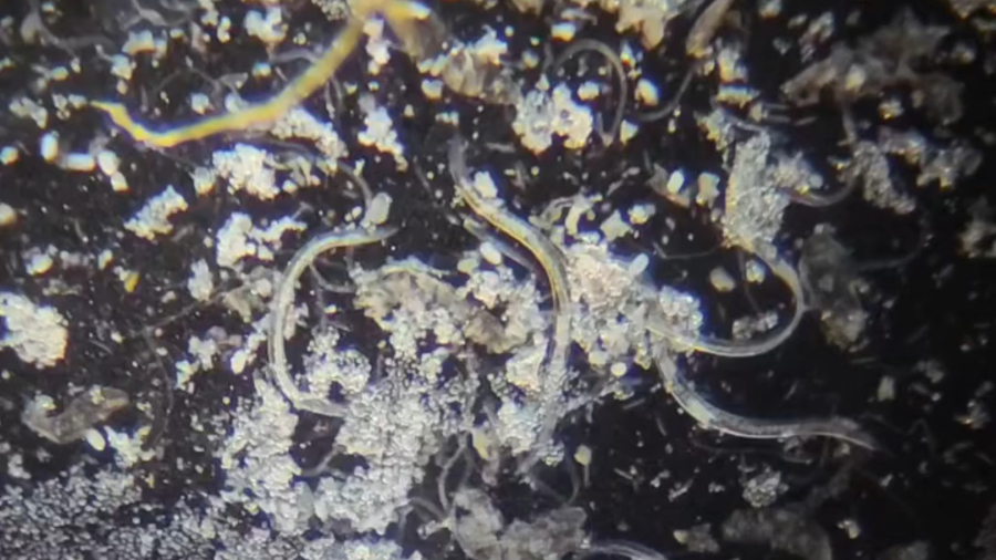 جانورانی که در سیاهی پشت ناخن‌ها زندگی می‌کنند را ببینید