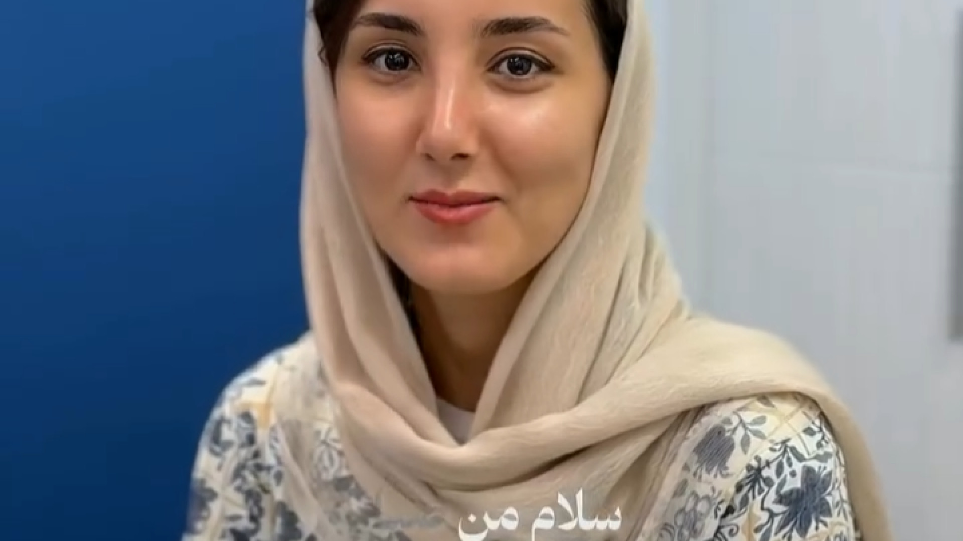 دو ماه بع از عمل بینی | دکتر جواد یزدانی