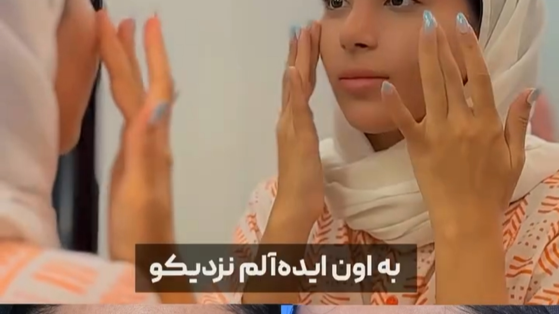 یک ماه و نیم بعد از عمل بینی | دکتر جواد یزدانی