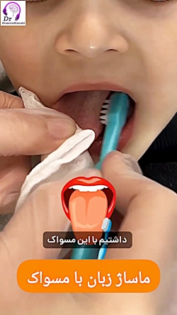 ماساژ کنار زبان در گفتاردرمانی