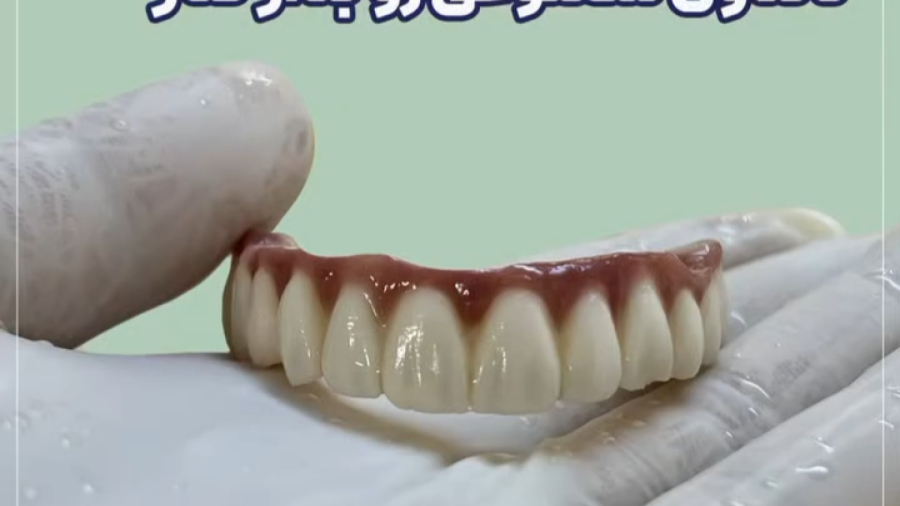 دندان مصنوعی رو بزار کنار ... | دکتر ستاره هاشمی