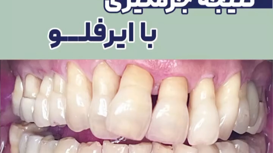 نتیجه جرمگیری با ایرفلو | دکتر ستاره هاشمی