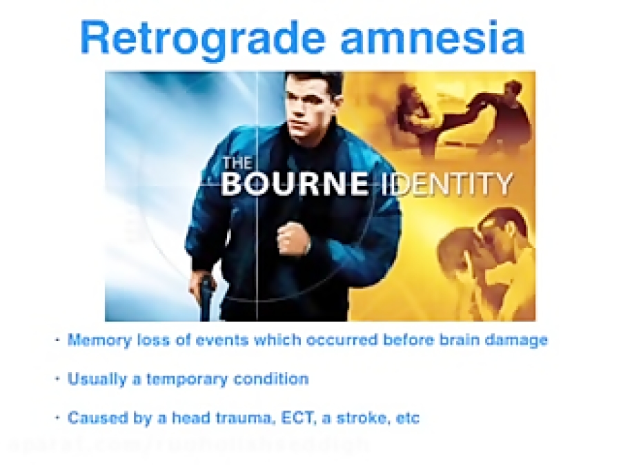 anterograde amnesia synonym