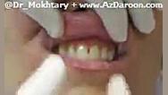 نمونه آموزش روش بی حسی موضعی و بلوک عصبی برداشتن توده