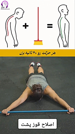 اصلاح قوز پشتی (کیفوز)