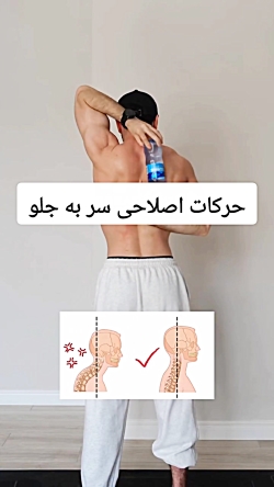 اصلاح وضعیت سر به جلو با حرکات اصلاحی