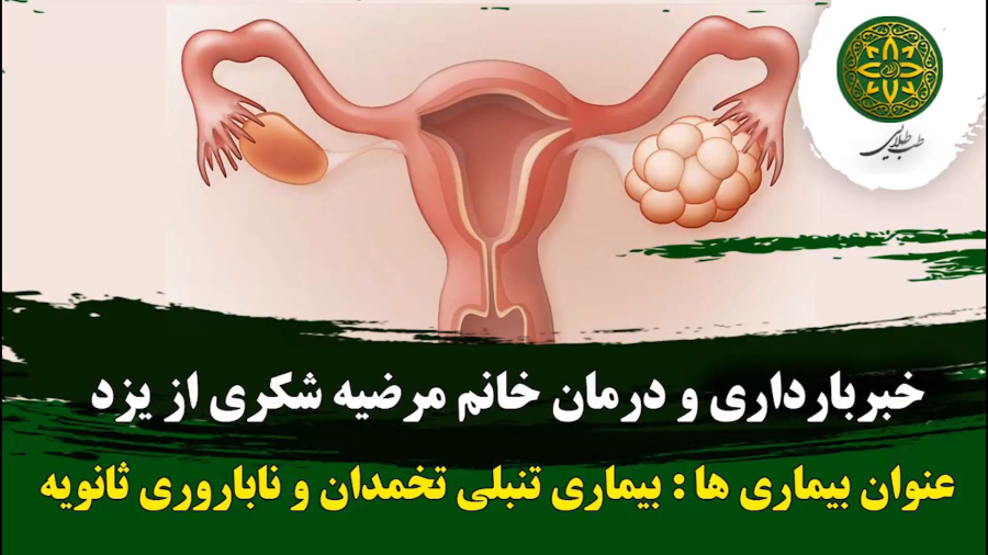 خبر بهبودی تنبلی تخمدان و بارداری پس از ۴ سال ناباروری | طب طلایی | 09190417521
