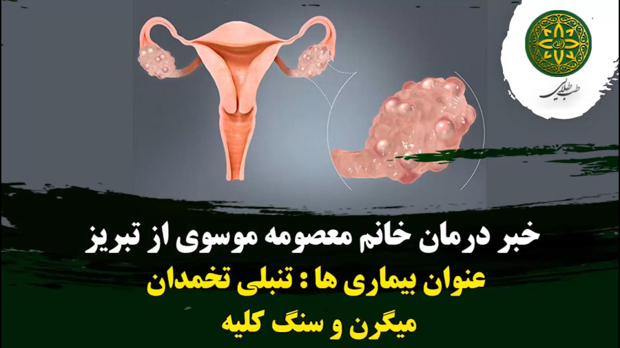 گزارش بهبودی تنبلی تخمدان، میگرن و سنگ کلیه | طب طلایی | 09190417521