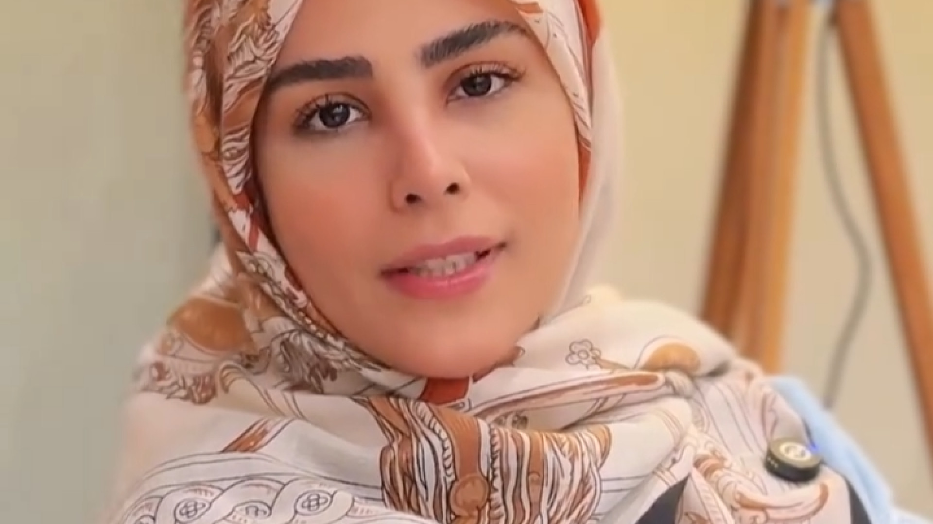 نتیجه بی نظیر جراحی بینی | دکتر جواد یزدانی