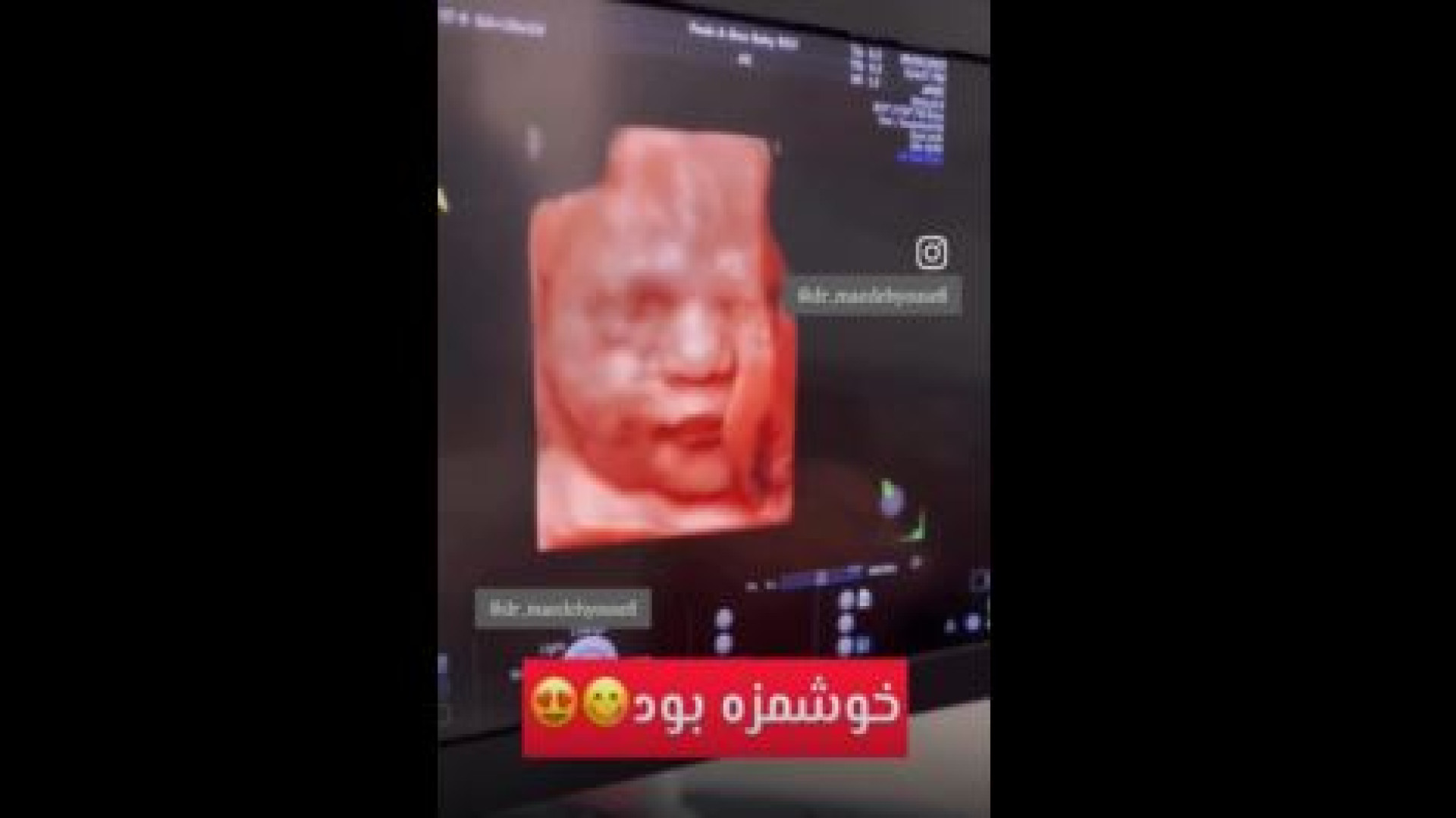 تاثیر شیرینی خوردن مادر بر جنین