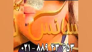 کاشت ریش و سبیل به روش SUT مرکز مو رنسانس سیستم ارزیابی هیستوترمیک