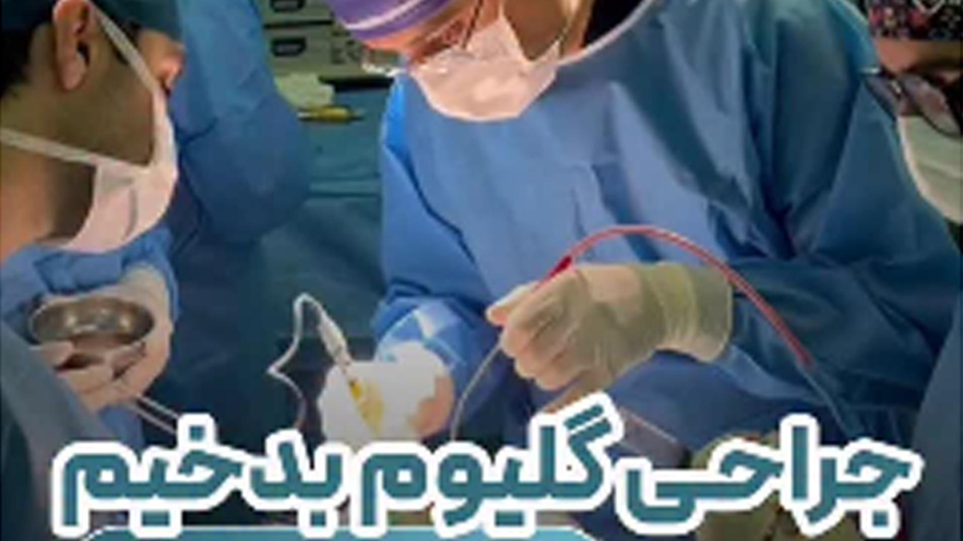 ‪‪‪‪‪‪‪‪‪جراحی گلیوم بدخیم مغزی | دکتر آرش فتاحی