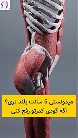 رفع گودی کمر با حرکات اصلاحی