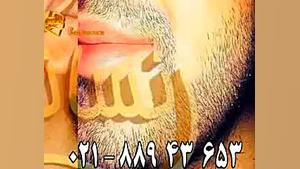 کاشت ریش و سبیل - کاشت مو و ترمیم مو رنسانس کپسول اندوسکوپی