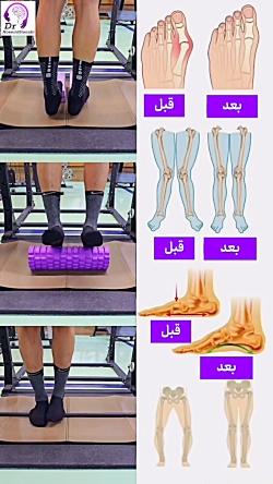 تمرین های کاردرمانی صافی کف پا