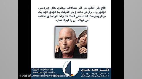 فلج بلز و آنچه باید بدانید پروتز سینه