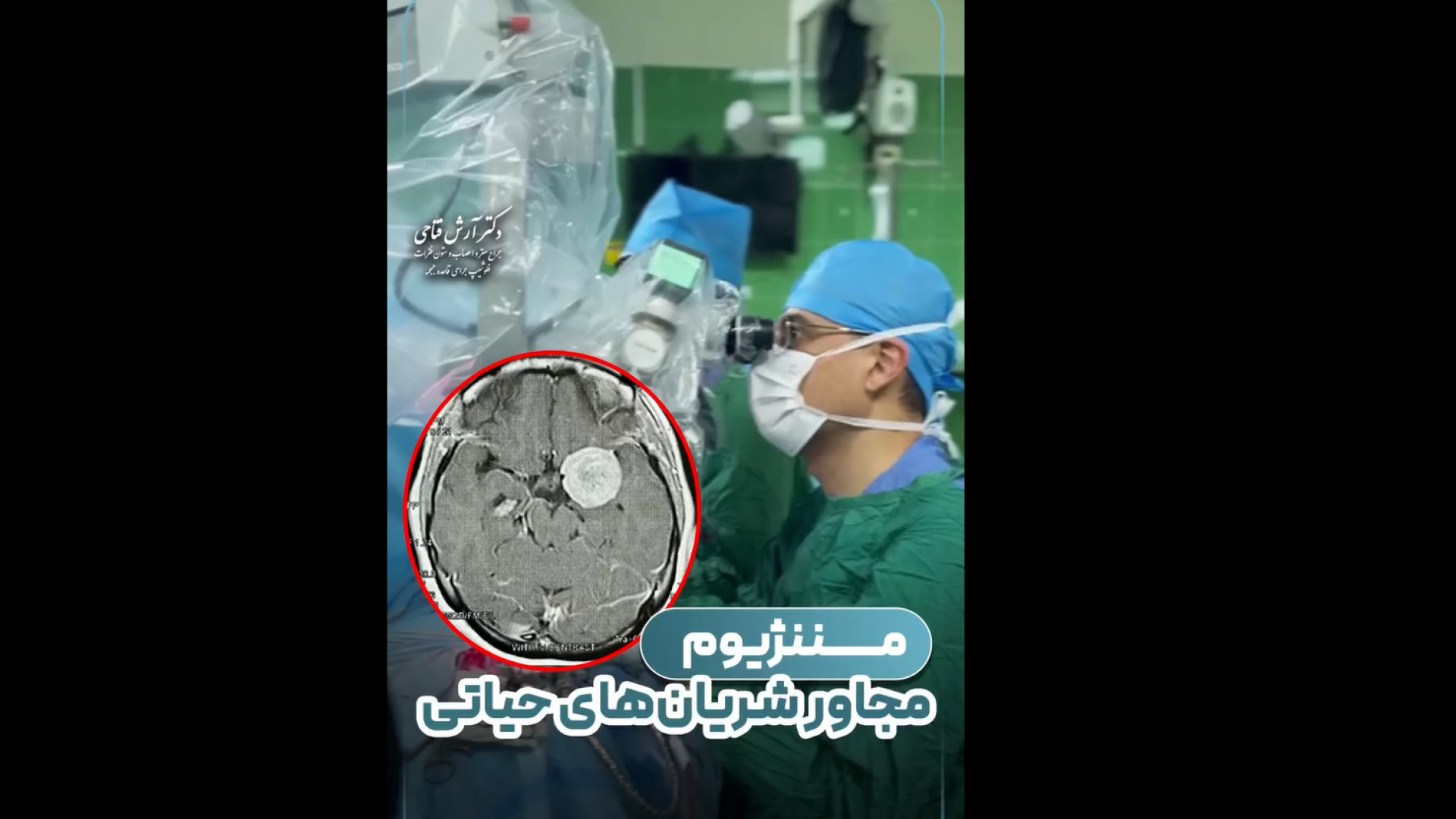 کیس بیماری مننژیوم | دکتر آرش فتاحی