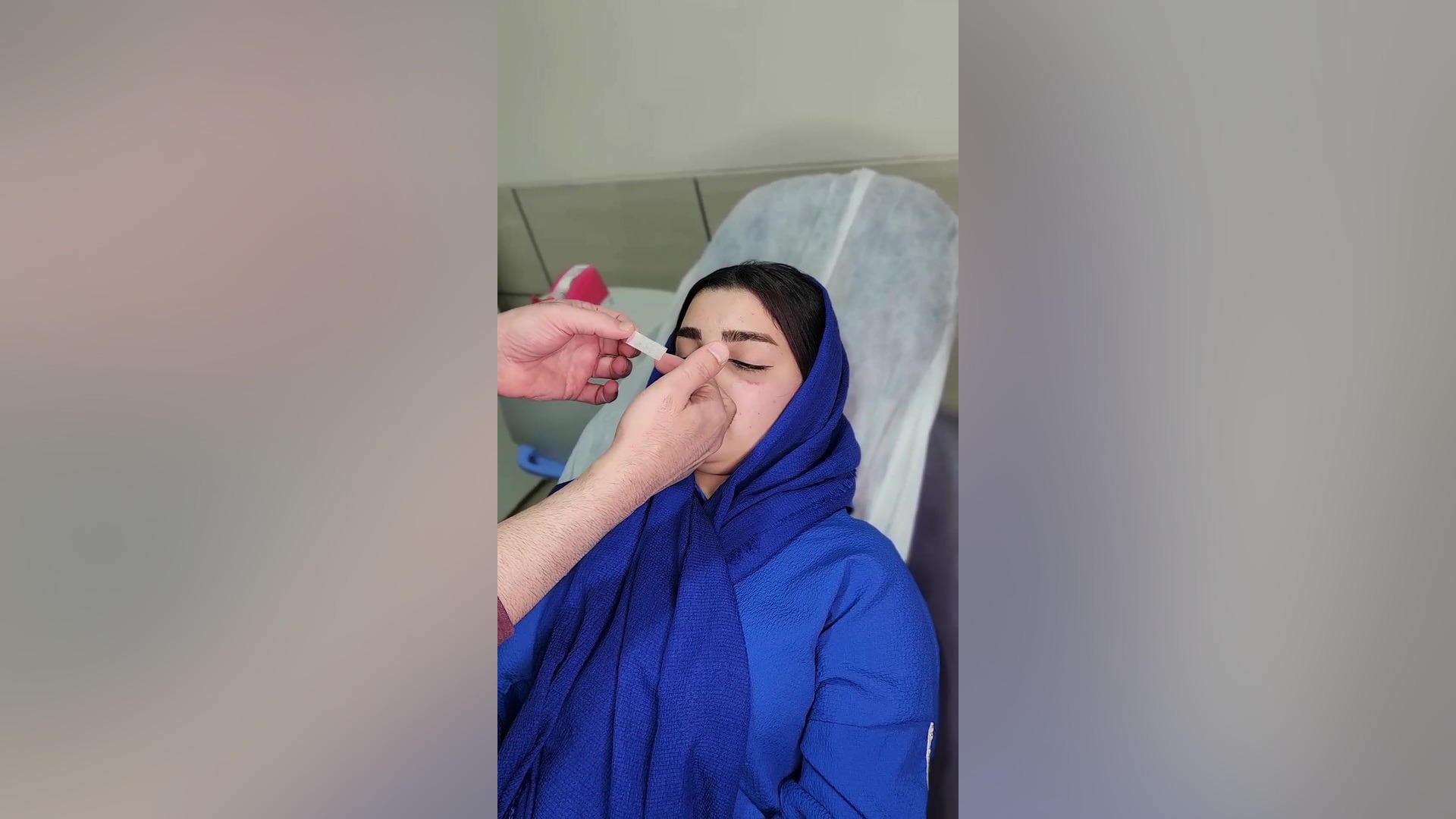 آموزش نحوه چسب زدن رینوپلاستی