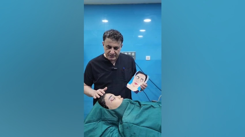 لیفت اندوسکوپی ابرو و پیشانی | دکتر حسینی نژاد
