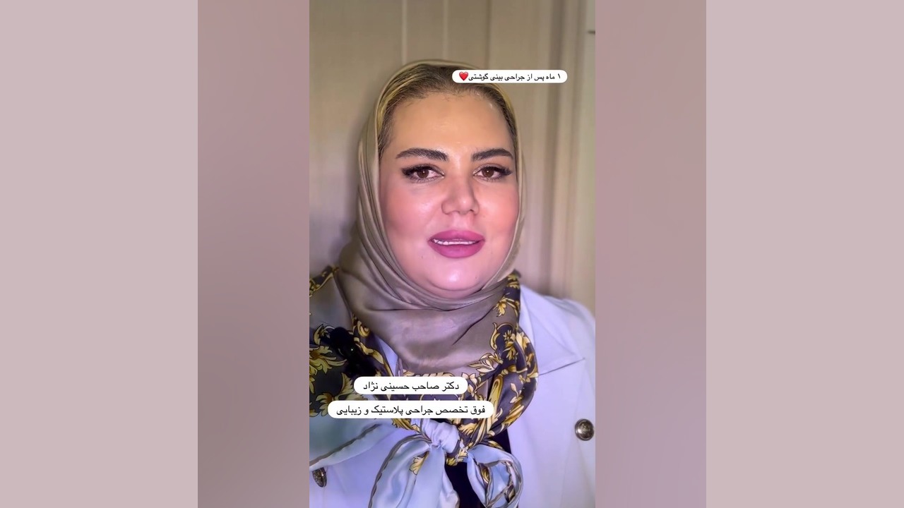 یک ماه بعد از جراحی بینی گوشتی | دکتر صاحب حسینی نژاد