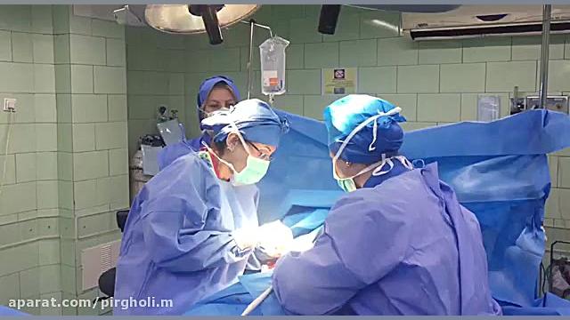 ماموپلاستی یا عمل کوچک کردن سینه الکترود اپتوژنزی