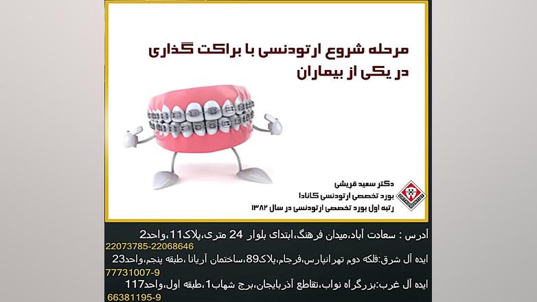 براکت گذاری در ارتودنسی-دکتر سعید قریشی دکتر سعید قریشی
