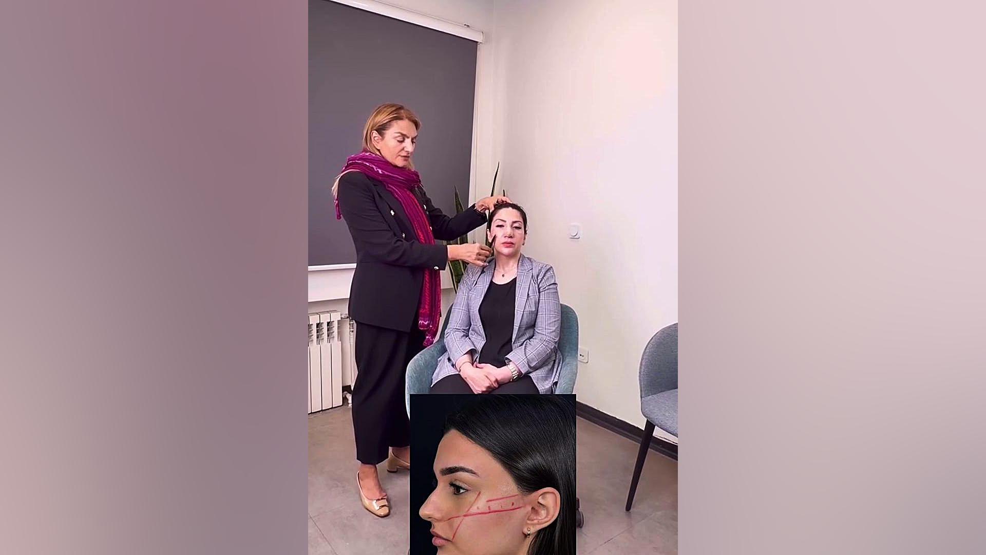 پروتز گونه | دکتر ماریا مرادی