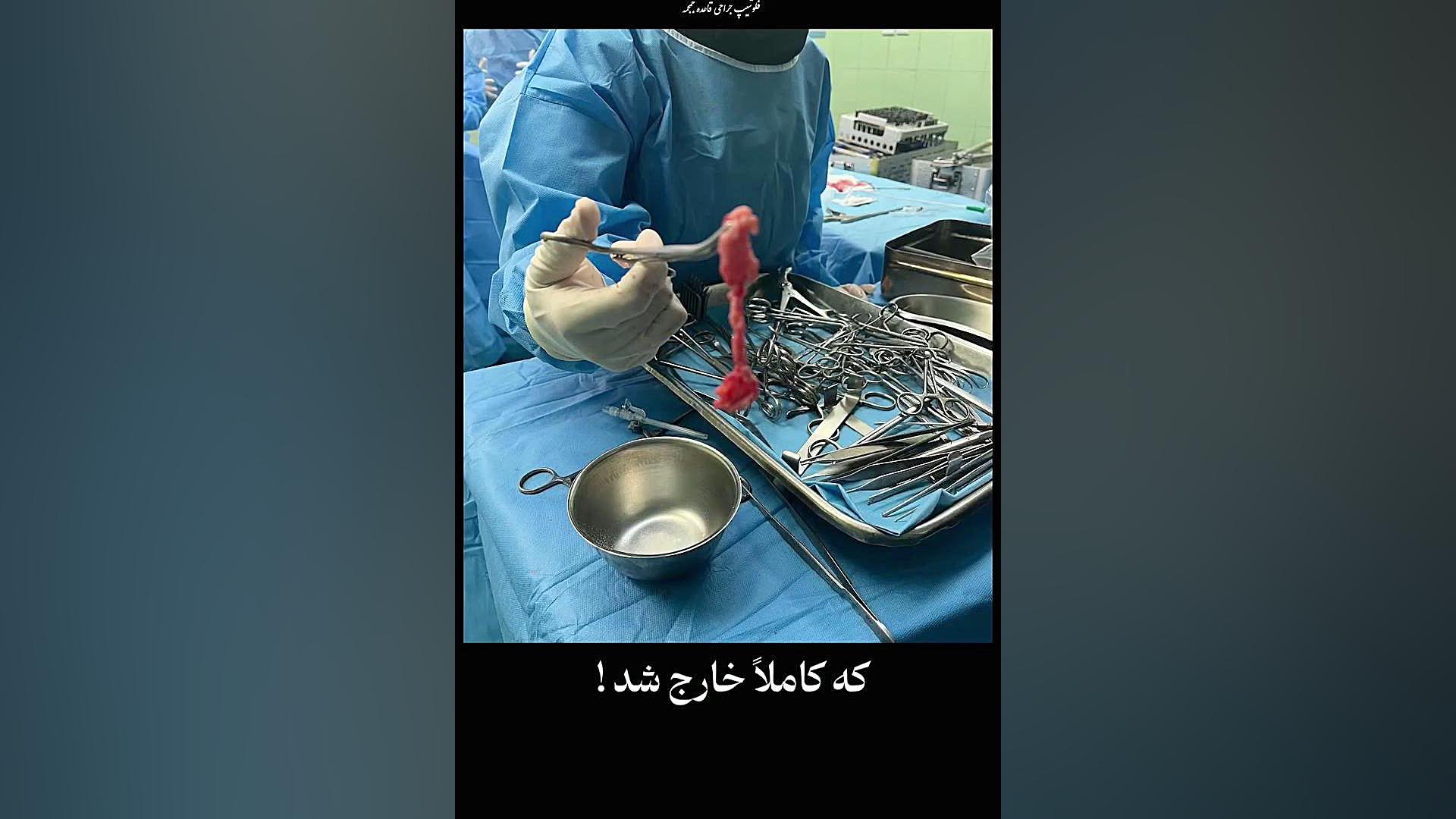 فلج ناگهانی پا  | دکتر فتاحی