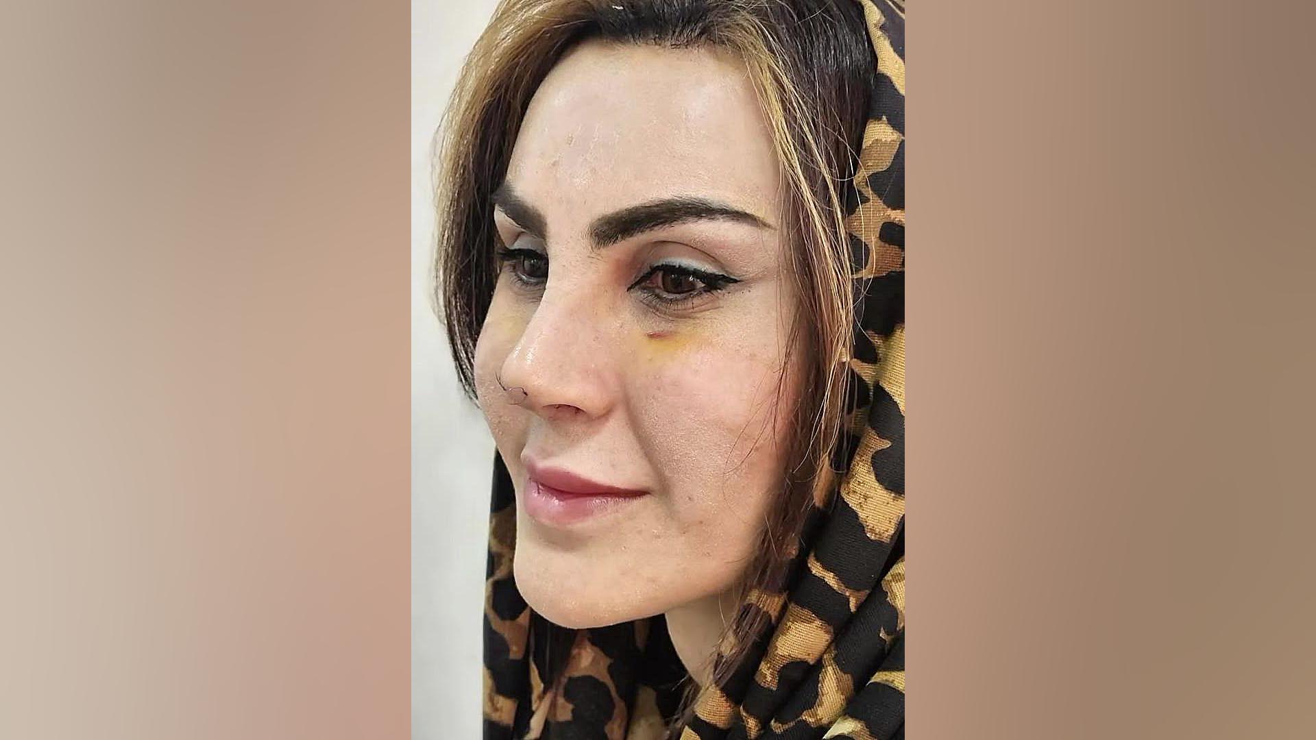 جراحی ترکیبی | دکتر صاحب حسینی نژاد