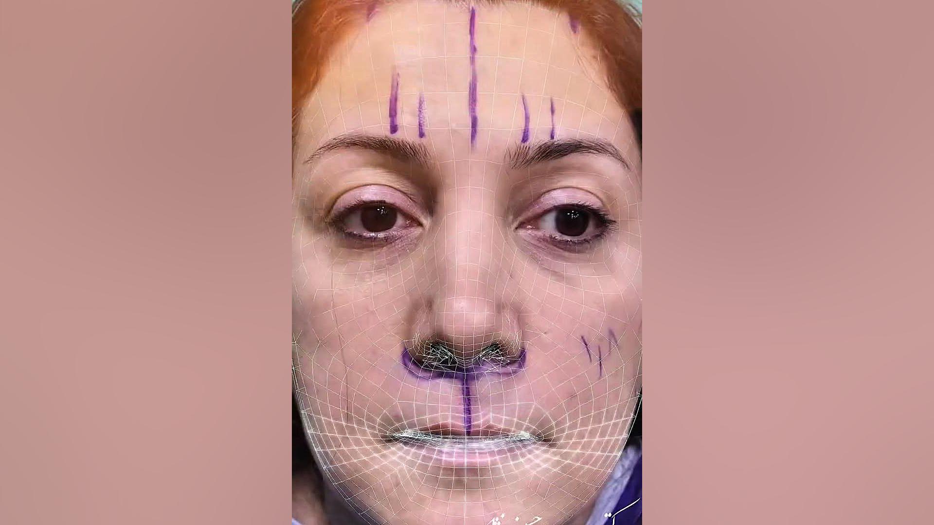 چند جراحی بصورت همزمان | دکتر صاحب حسینی نژاد