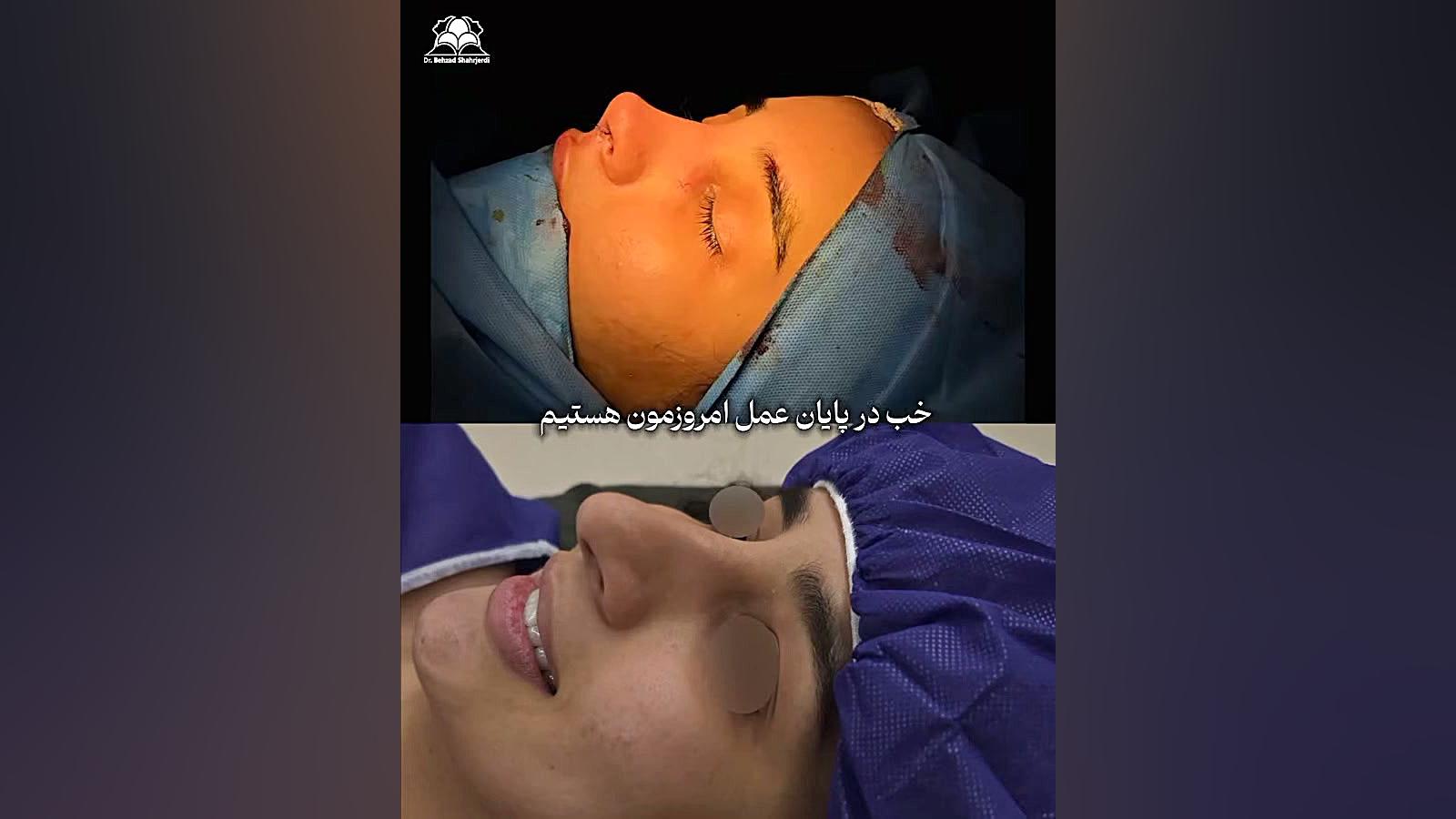 بینی نیمه فانتزی با دکتر بهزاد شهرجردی