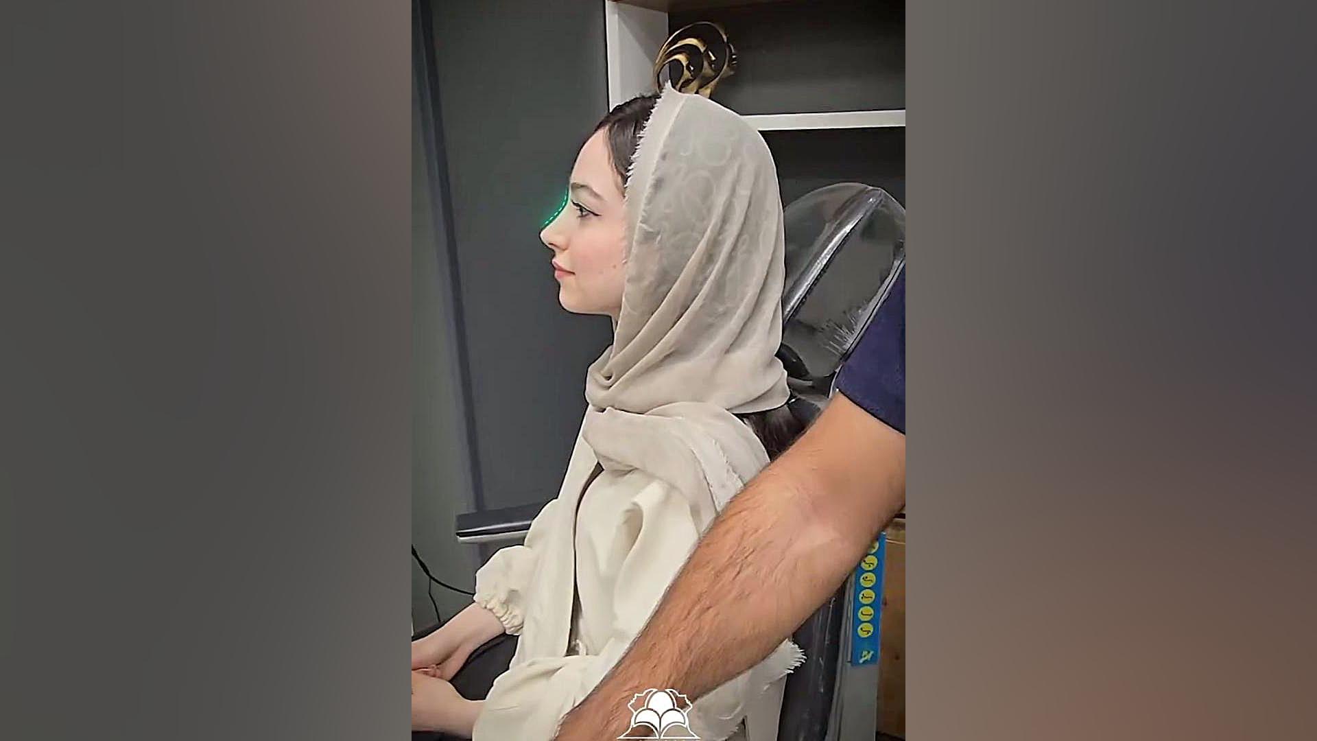 نتیجه 2 سال بعد از عمل بینی | دکتر بهزاد شهرجردی