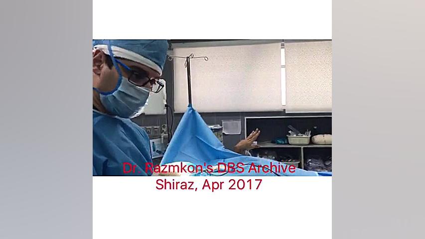 First rescue thalamotomy in Iran عمل جراحی تالاموتومی استفان کری