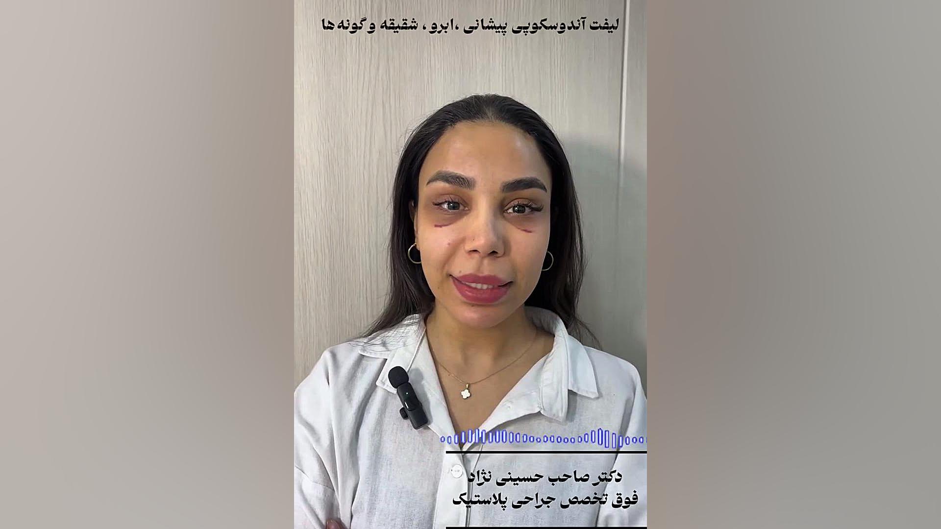 نتیجه ای عالی از لیفت صورت | دکتر صاحب حسینی نژاد