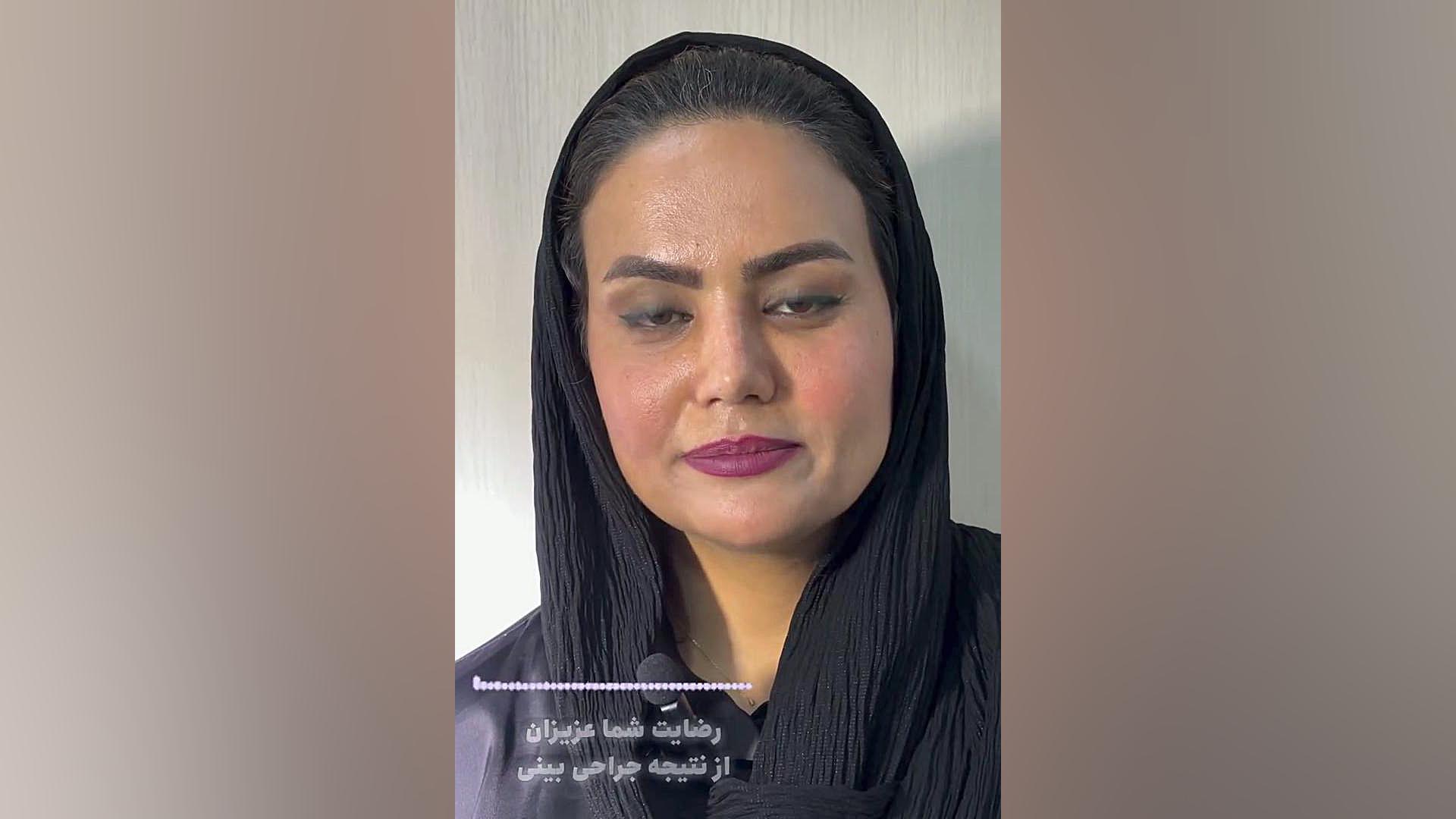 نتیجه جراحی زیبایی بینی | دکتر صاحب حسینی نژاد