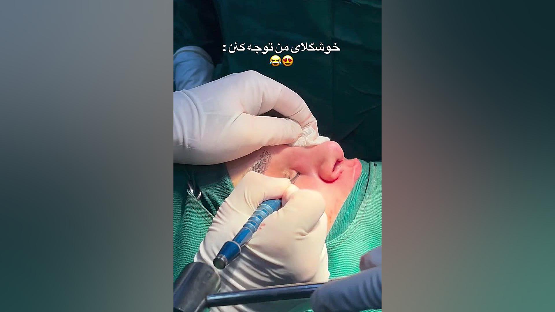 خط کانتور بینی | دکتر صاحب حسینی نژاد