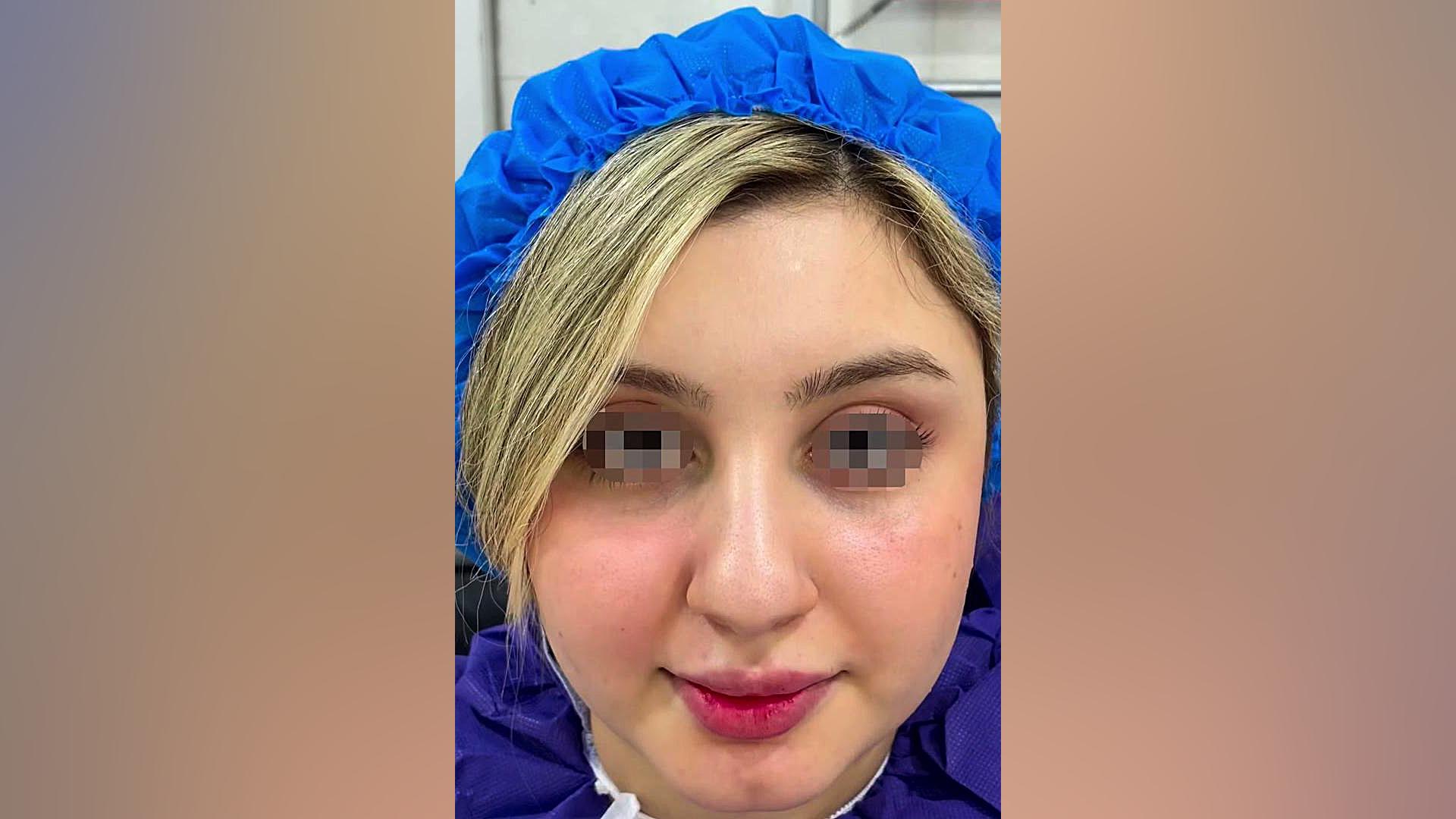 جراحی زیبایی بینی و نتیجه ای ماندگار | دکتر حسینی نژاد