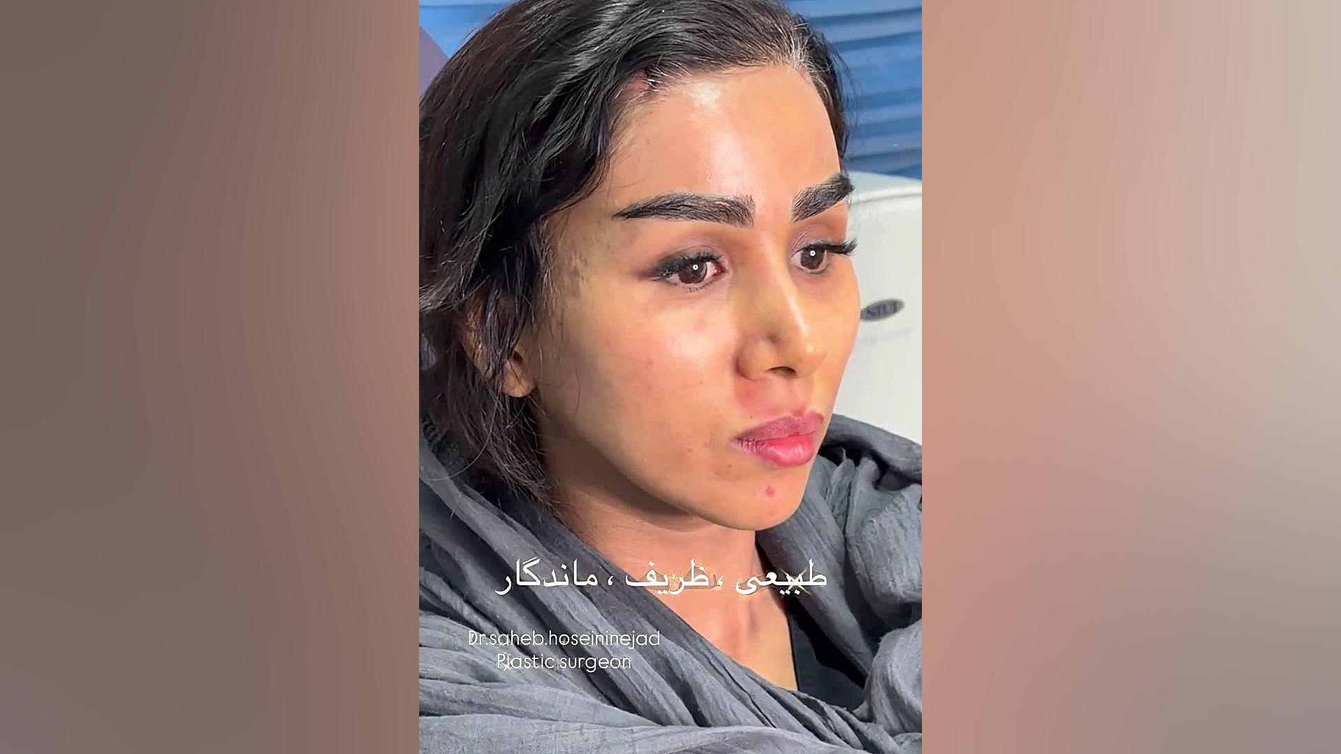 جراحی صورت | دکتر صاحب حسینی نژاد