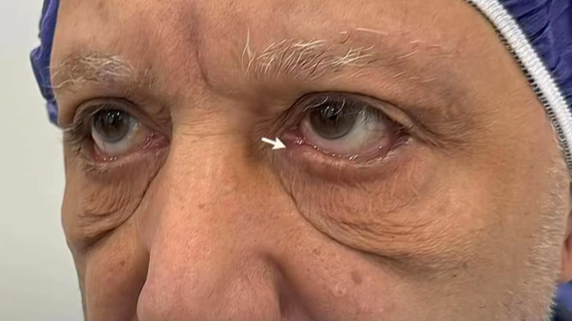 truncate dir-rtl
