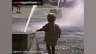 کلیپ نوزاد و کودکانه لیفت پیشانی