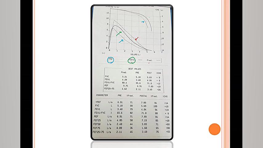 اسپیرومتری پروتز سینه