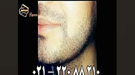 کاشت ریش و سبیل - کاشت مو و ترمیم مو رنسانس برداشتن خال