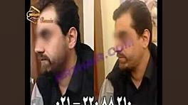 کاشت ریش و سبیل - کاشت مو و ترمیم مو رنسانس علامت کرنیگ