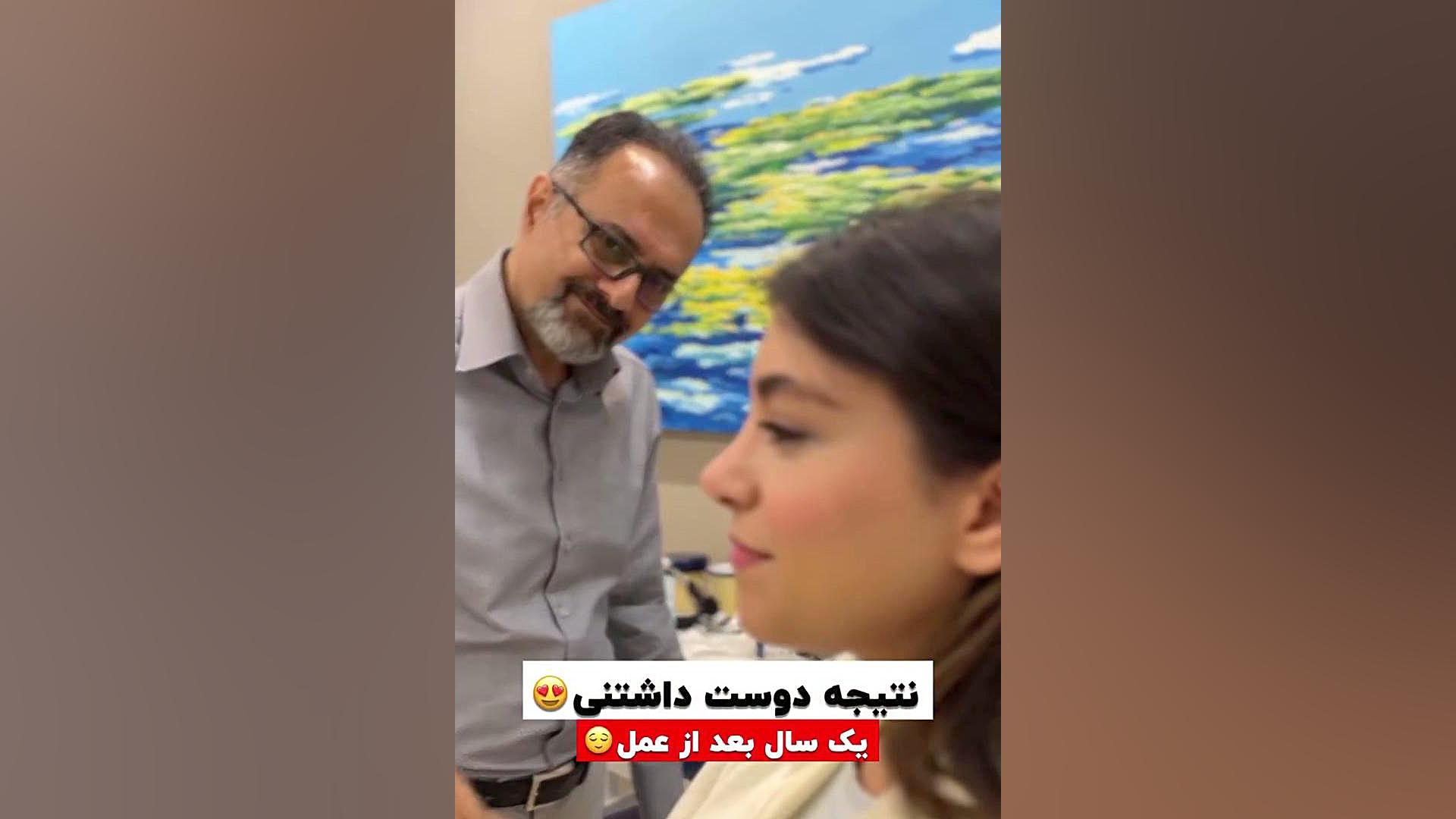 یک سال بعد از عمل بینی | دکتر جواد یزدانی