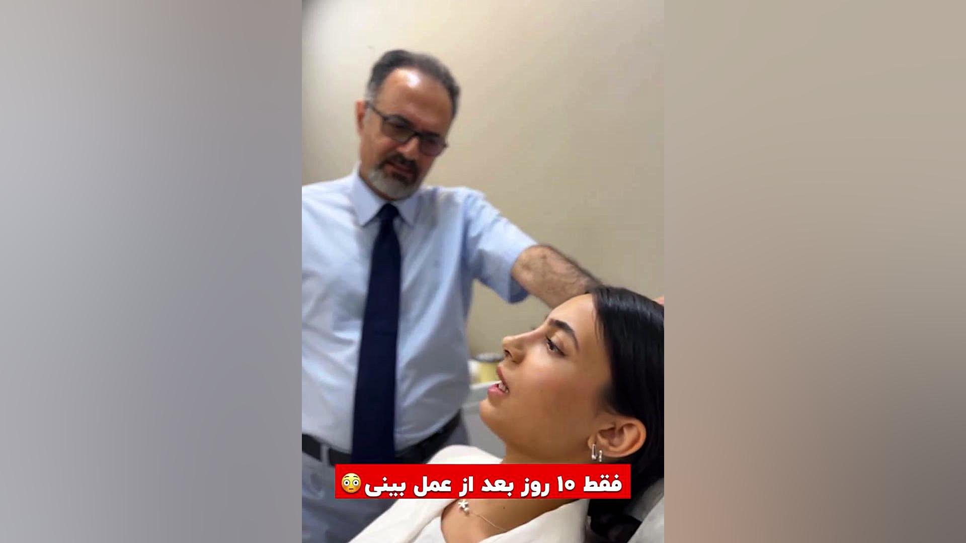 10 روز بعد از عمل بینی بدون کبودی و ورم شدید | دکتر یزدانی